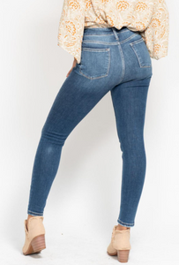 High-Rise Button Fly Skinny Jeans